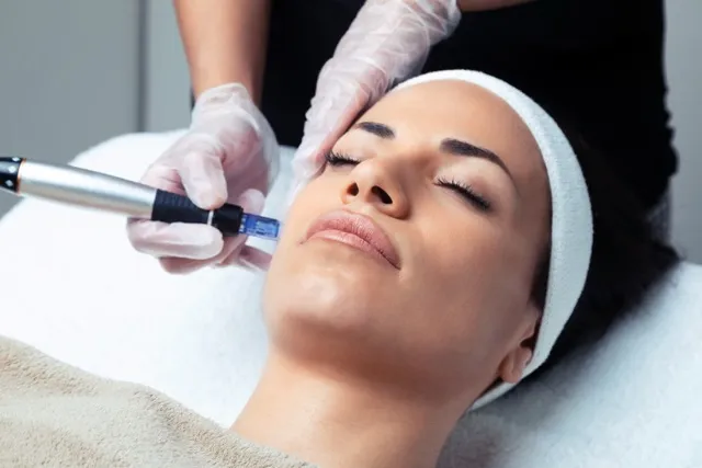 Microneedling